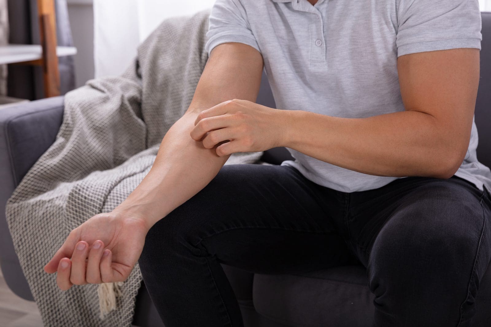 Eczema Causes, Symptoms & Treatment ACAAI Public site